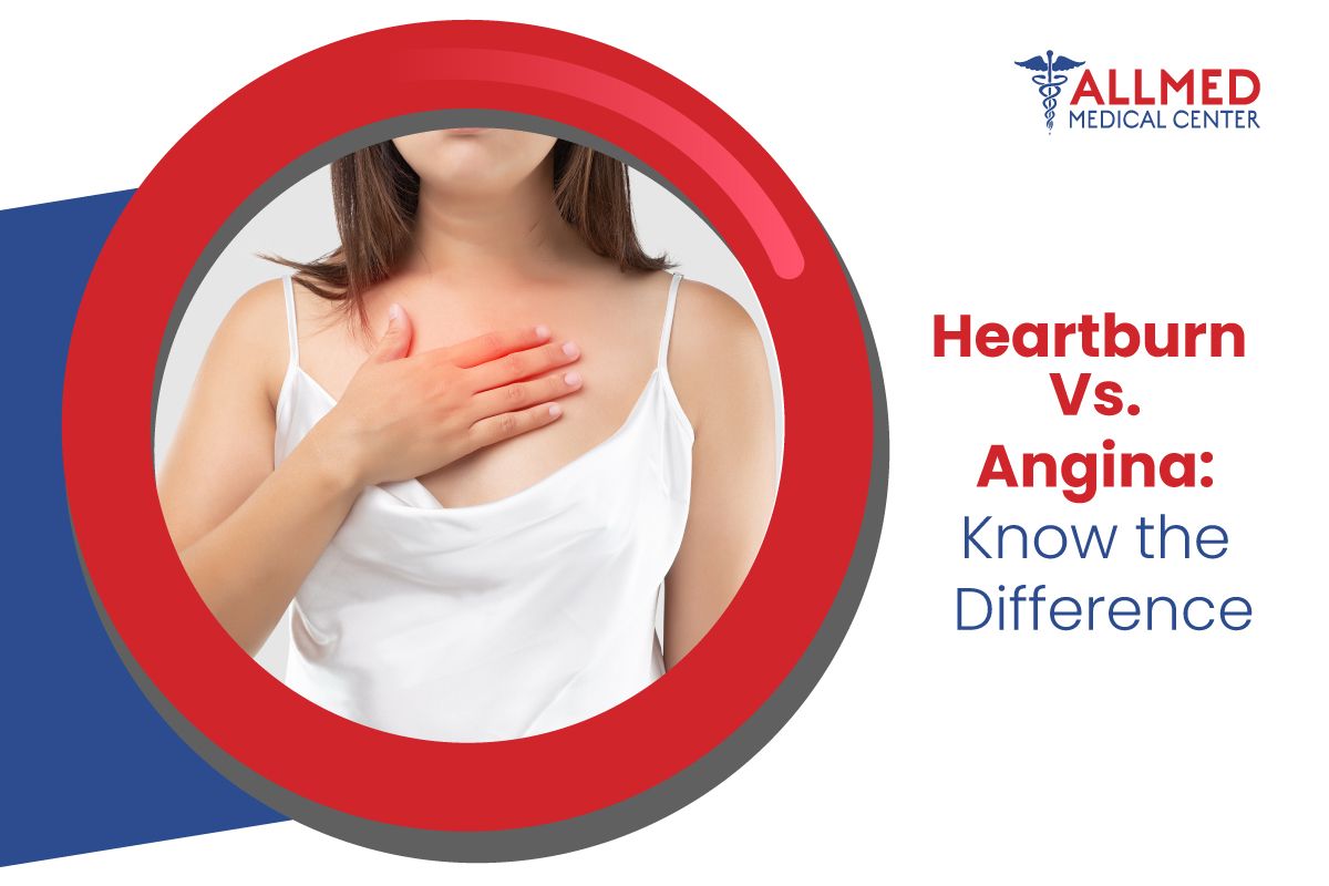 Heartburn Vs. Angina: Know the Difference.