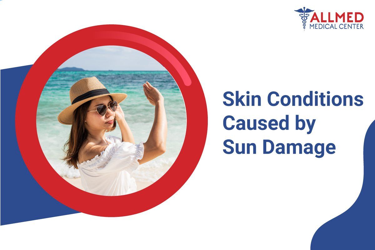 Skin Conditions Caused by Sun Damage