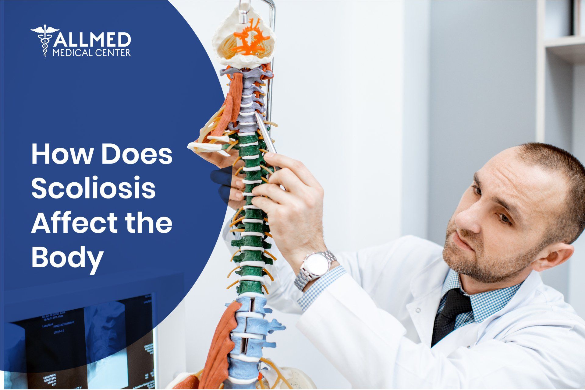 How Scoliosis Affects the Body