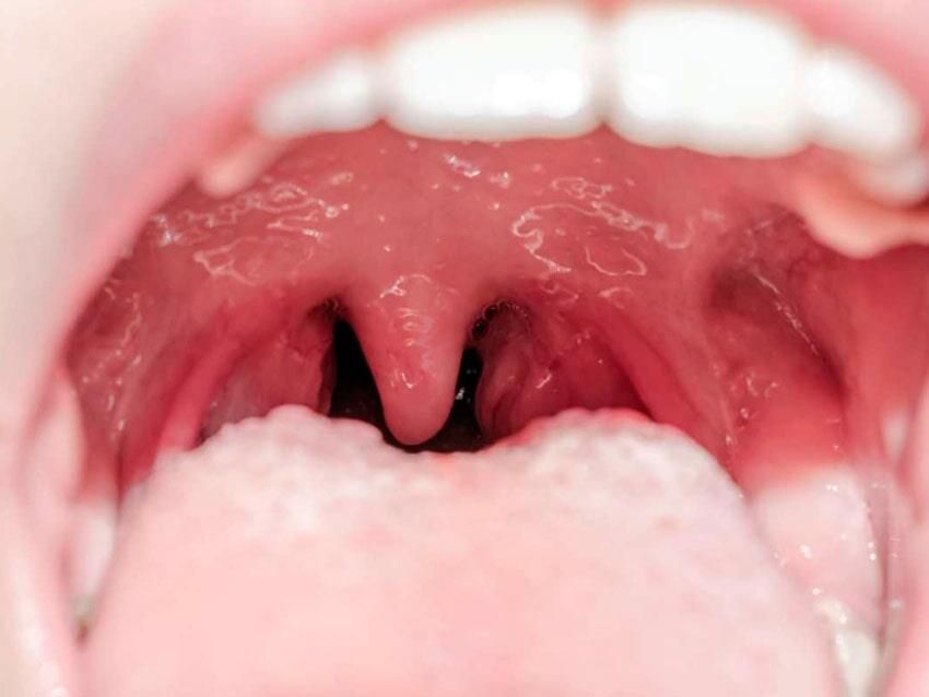 DR. IGNACIO VÁZQUEZ VILLALÓN