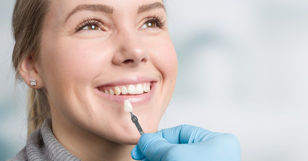7 Things to Consider Before Getting Dental Veneers