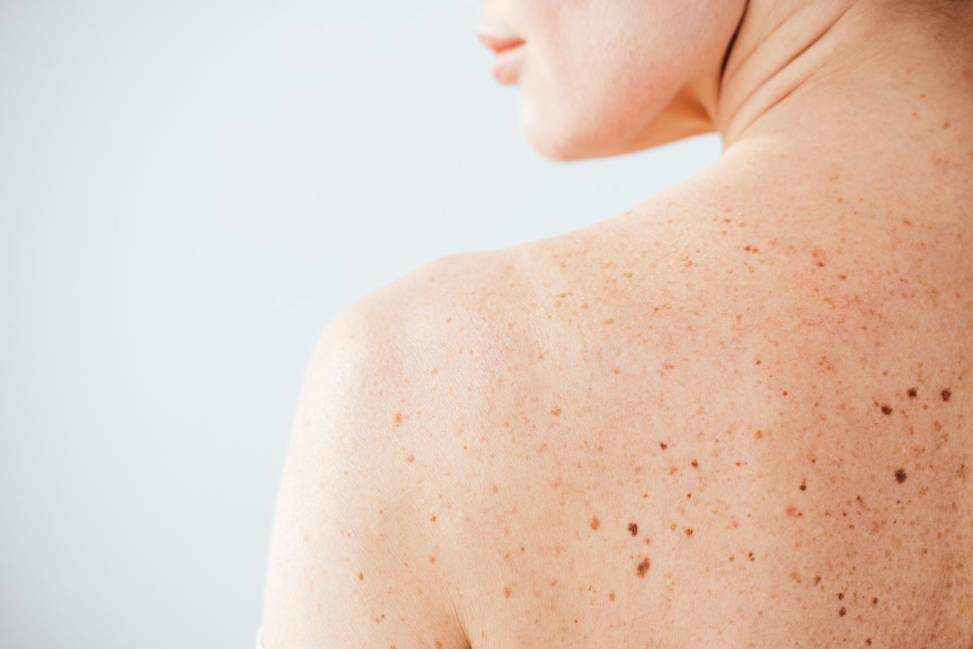 patient+seeking+skin+cancer+care+in+phoenix