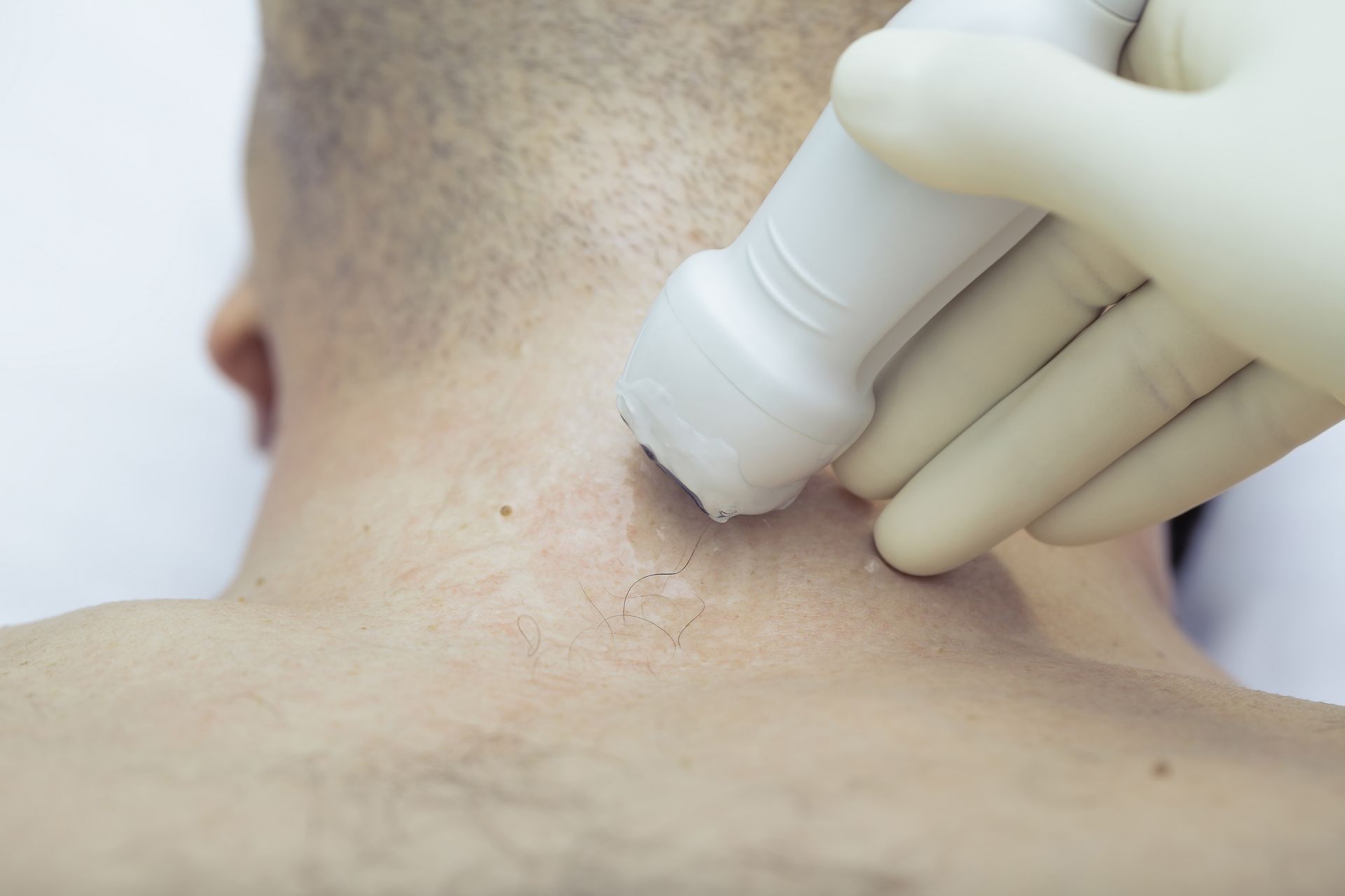 Gloved hand applying a handheld device to the back of a person’s neck Gloved hand applying a handheld device to the back of a person’s neck