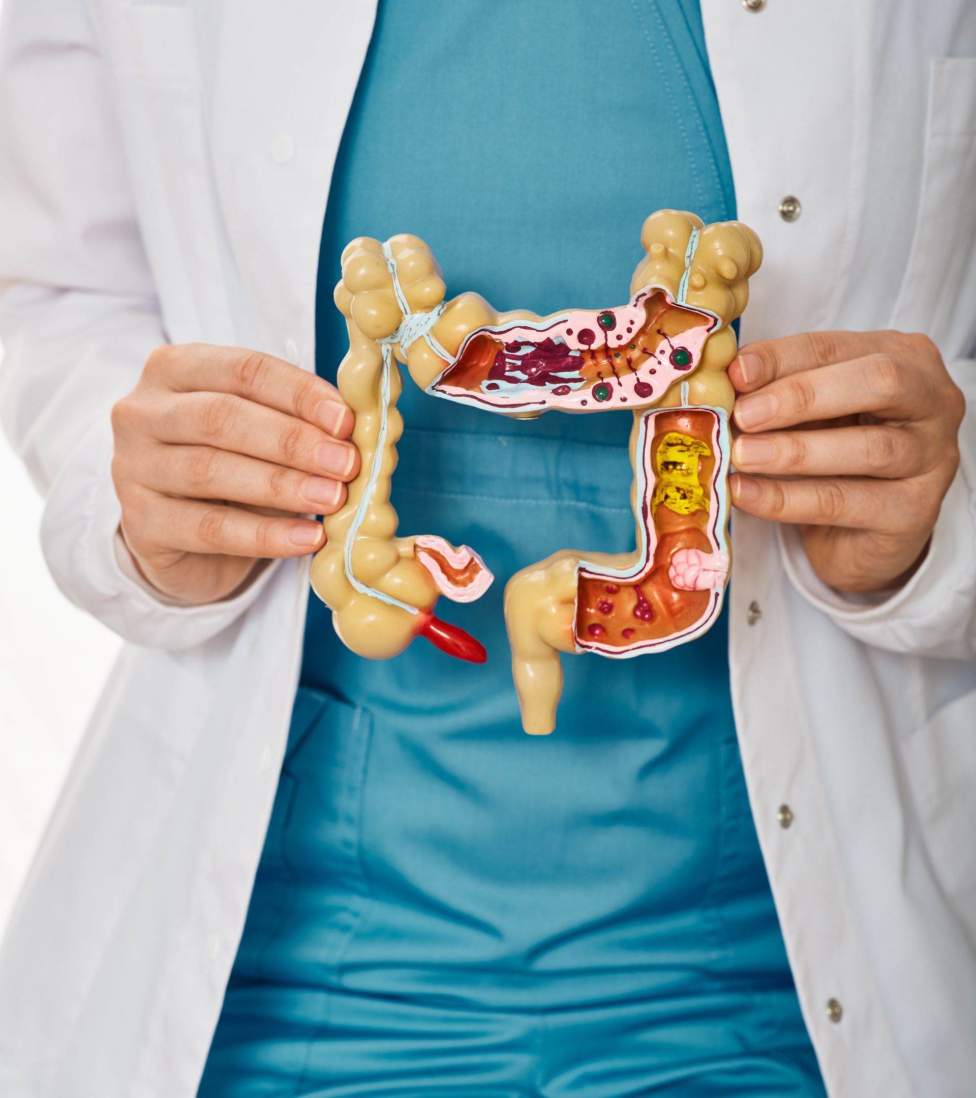 Doctor holding a colon model displaying areas of illness. Doctor holding a colon model displaying areas of illness.