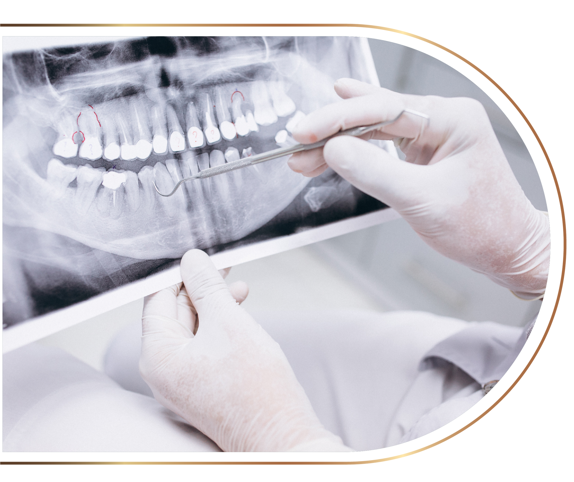 A dentist is examining an x-ray of a person 's teeth.