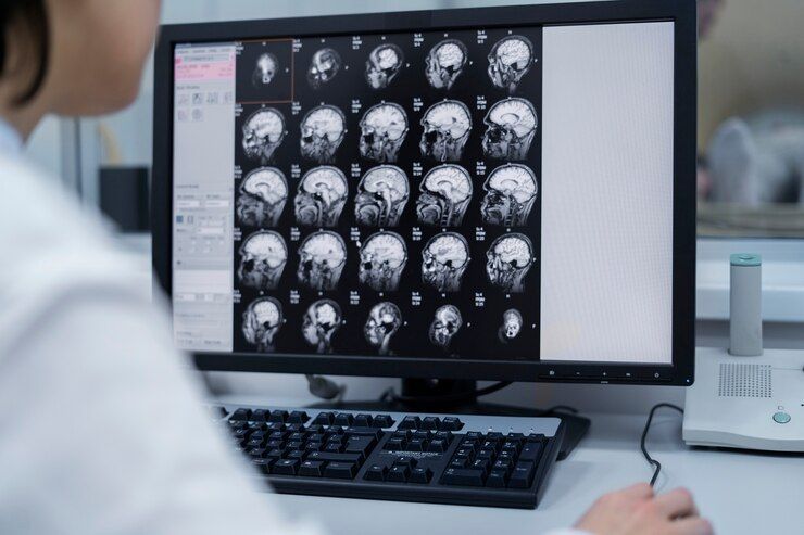 A dor de cabeça pode ser sintoma de tumor cerebral