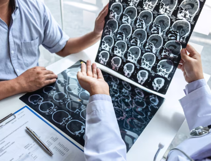 Cirurgia para tumor cerebral no Rio de Janeiro: Quando procurar um neurocirurgião?