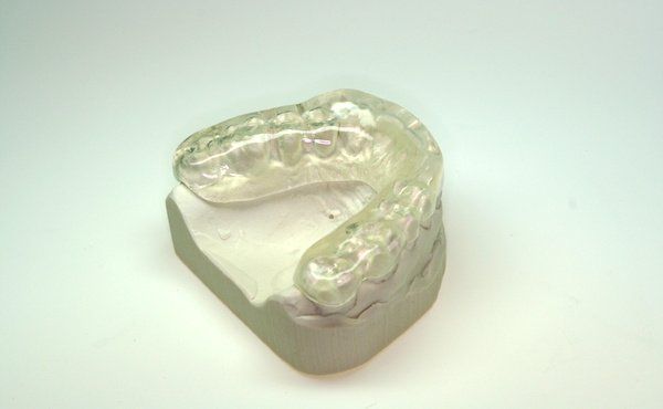 Aufbiss-Schiene bei Kiefergelenks-Problemen oder Zähneknirschen