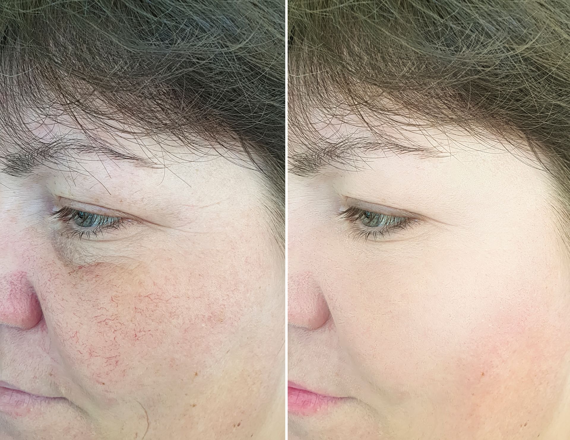 A before and after photo of a woman 's face.