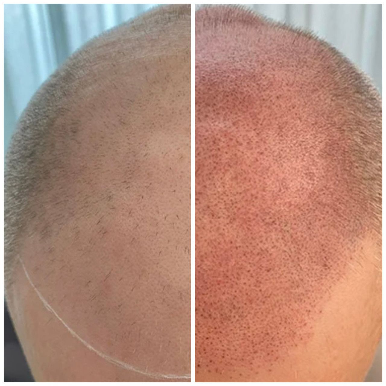 Eine Nahaufnahme des Gesichts einer Frau mit geschlossenen Augen.