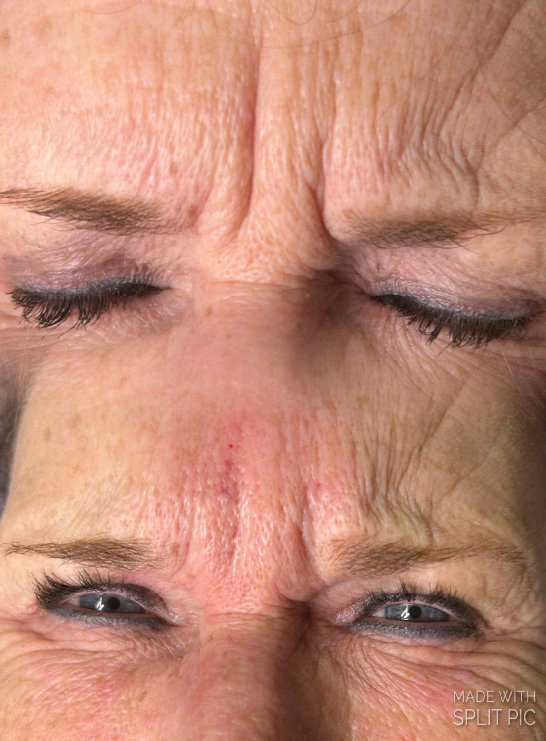 Eine Nahaufnahme der Stirn einer Frau mit Falten und geschlossenen Augen.