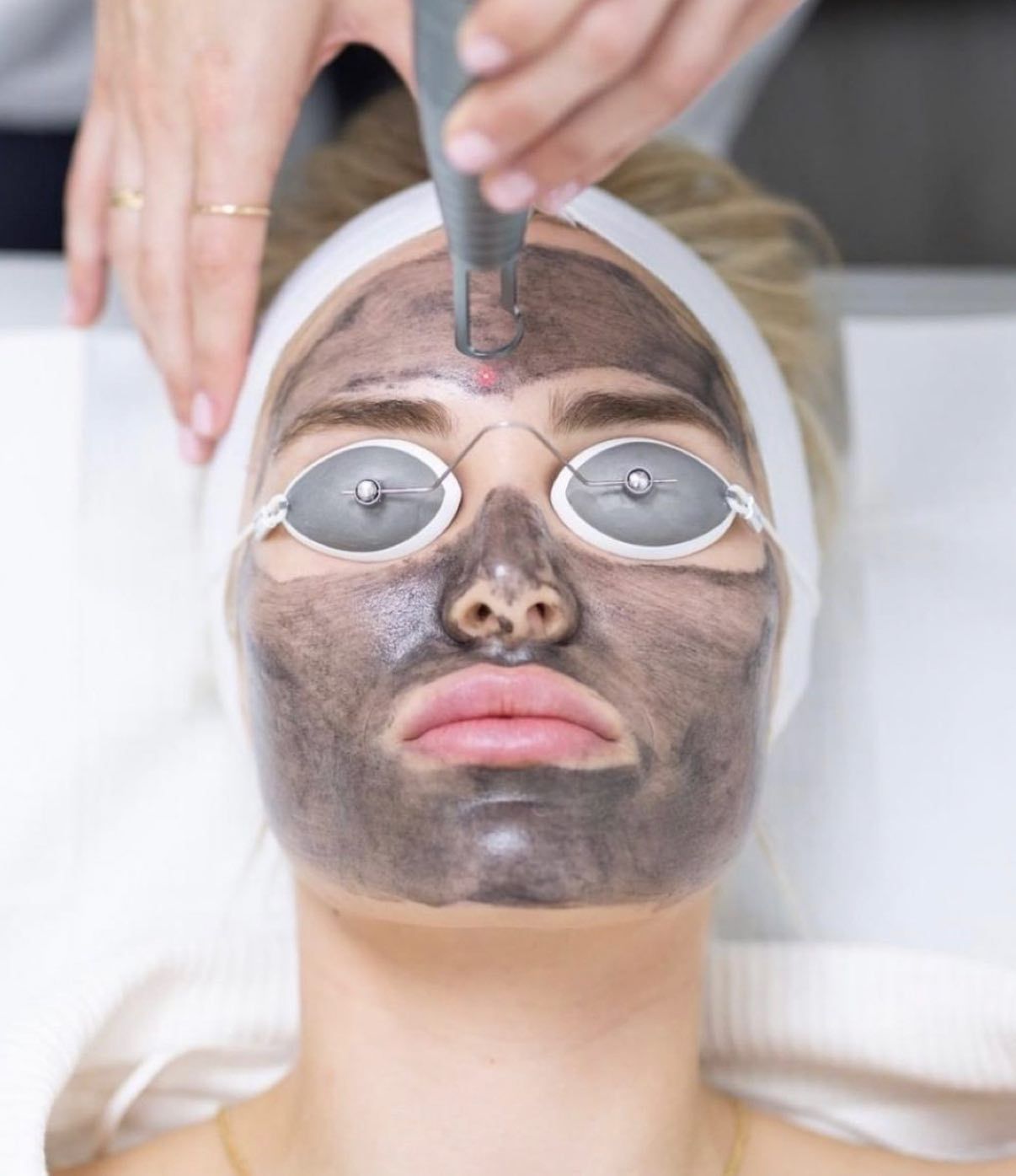 A Woman With a Black Mask on Her Face is Getting a Treatment — Renew Laser Clinic in Taree, NSW