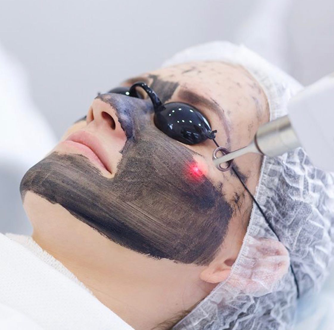 Laser Treatment On A Face