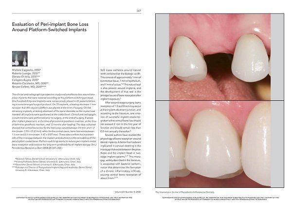 implantologia dentale