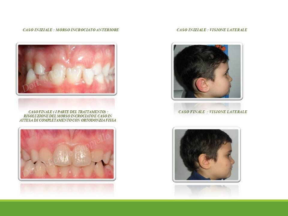 apparecchio dentale mobile