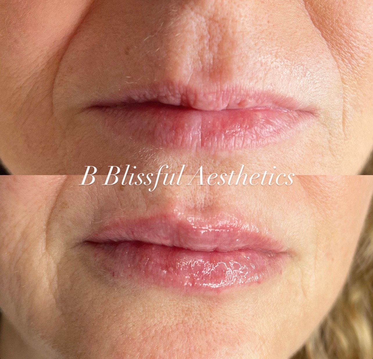 A close up of a woman 's lips with the words blissful aesthetics written on it