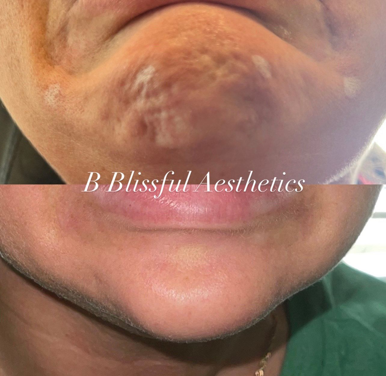 A close up of a woman 's face with blissful aesthetics written on it