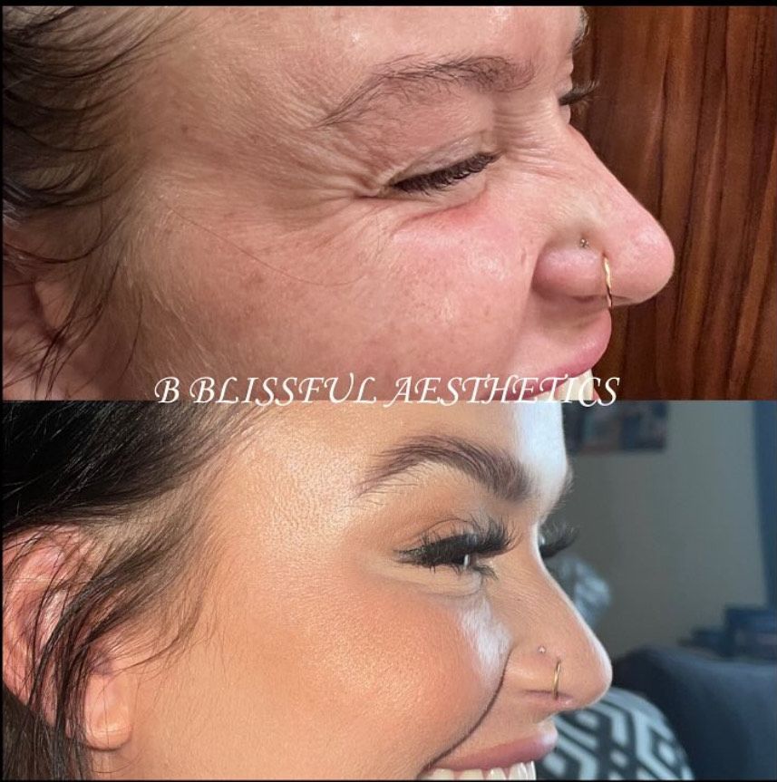 A before and after photo of a woman 's face.