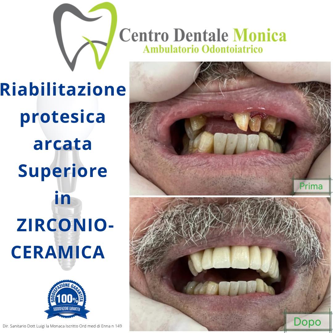 servizio di riabilitazione protesica di qualità