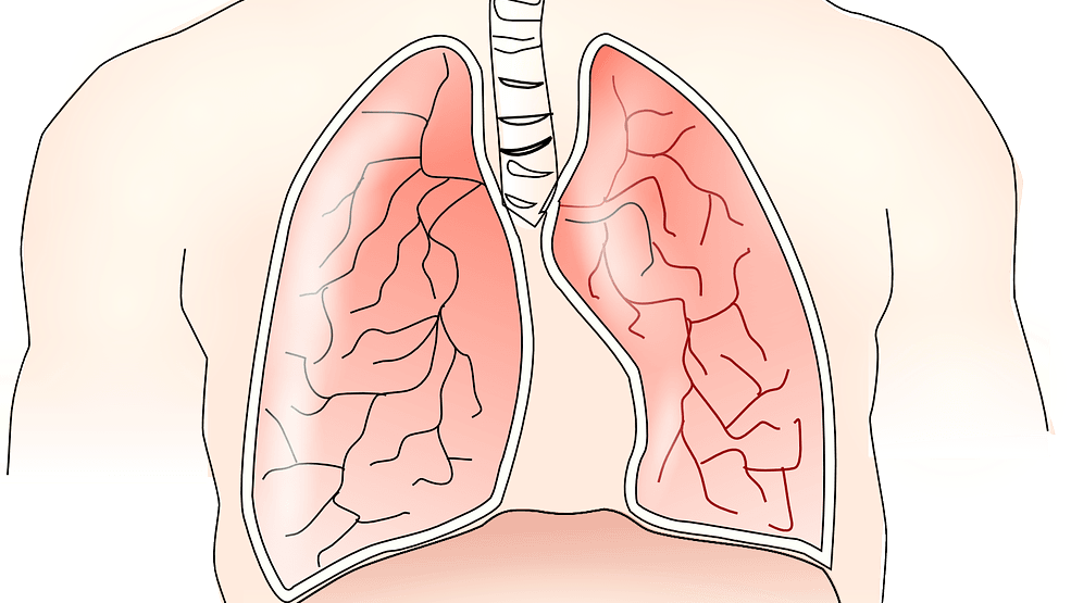 COPD Ede