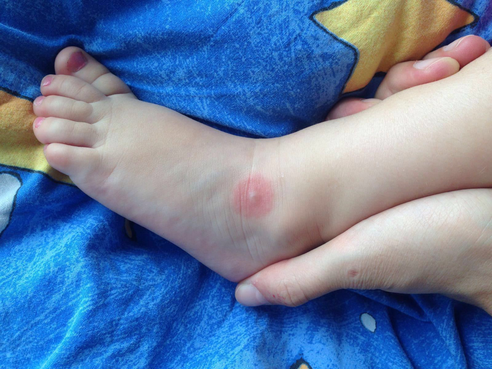 Borrelien-Diagnostik