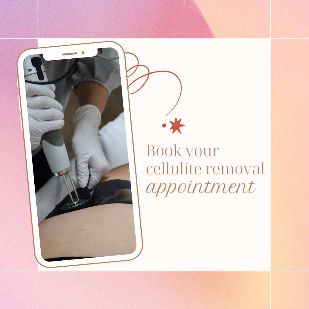 A cell phone with a picture of a person getting a cellulite removal appointment.