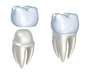two process of dental crown - Lincoln, NE - Blome Family Dentistry