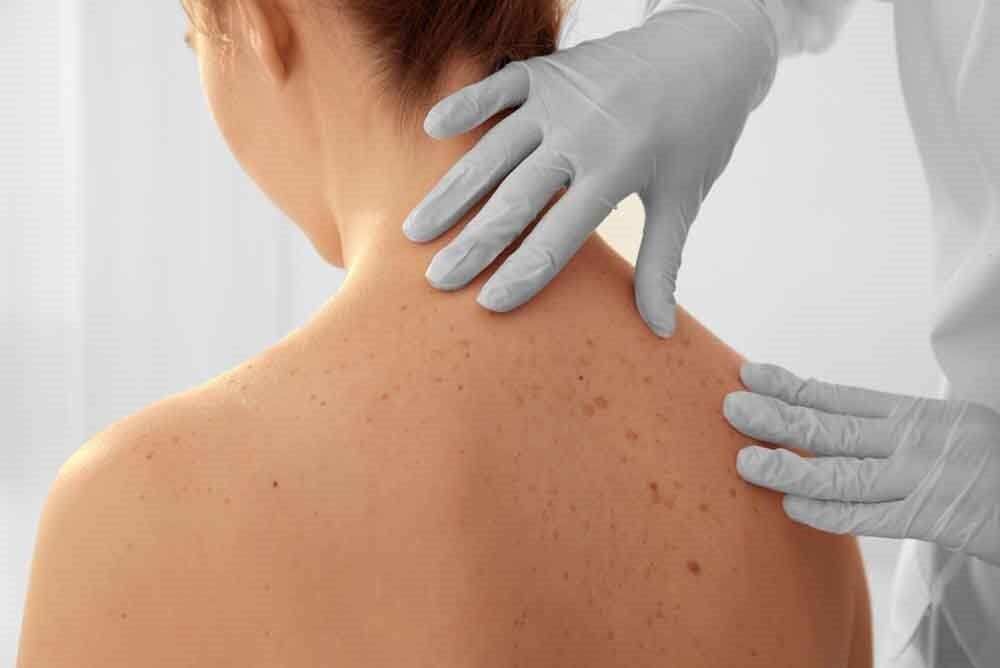 A Woman Is Getting Her Skin Examined By A Doctor — Mall Medical Centre In Alice Springs, NT