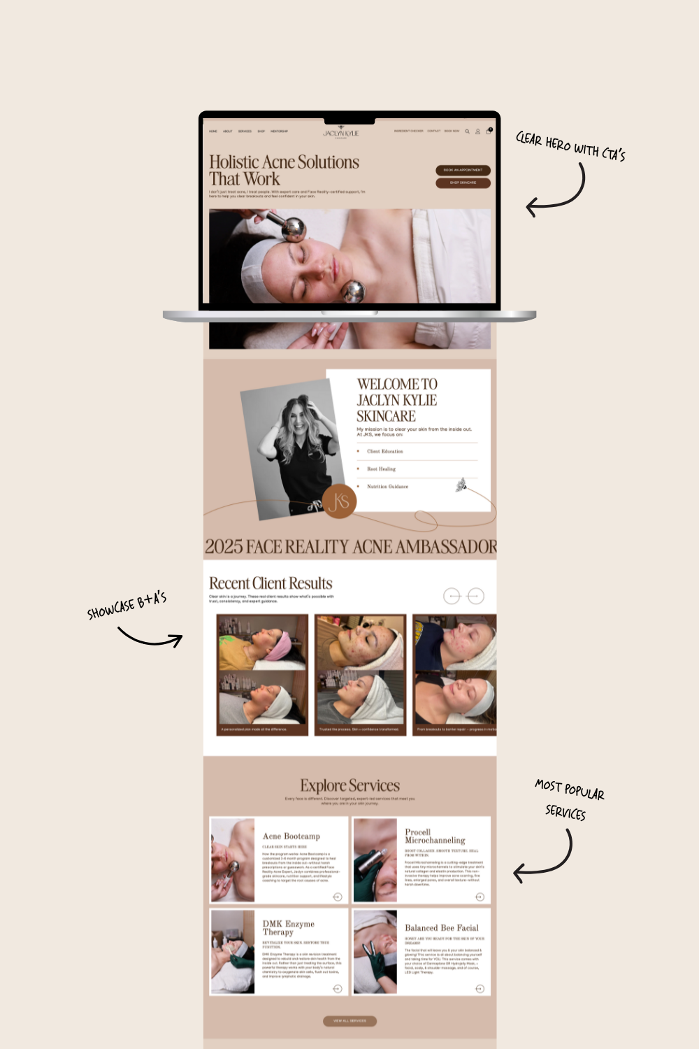 Laptop displaying a spa website. Features woman's face, treatments, and service descriptions.