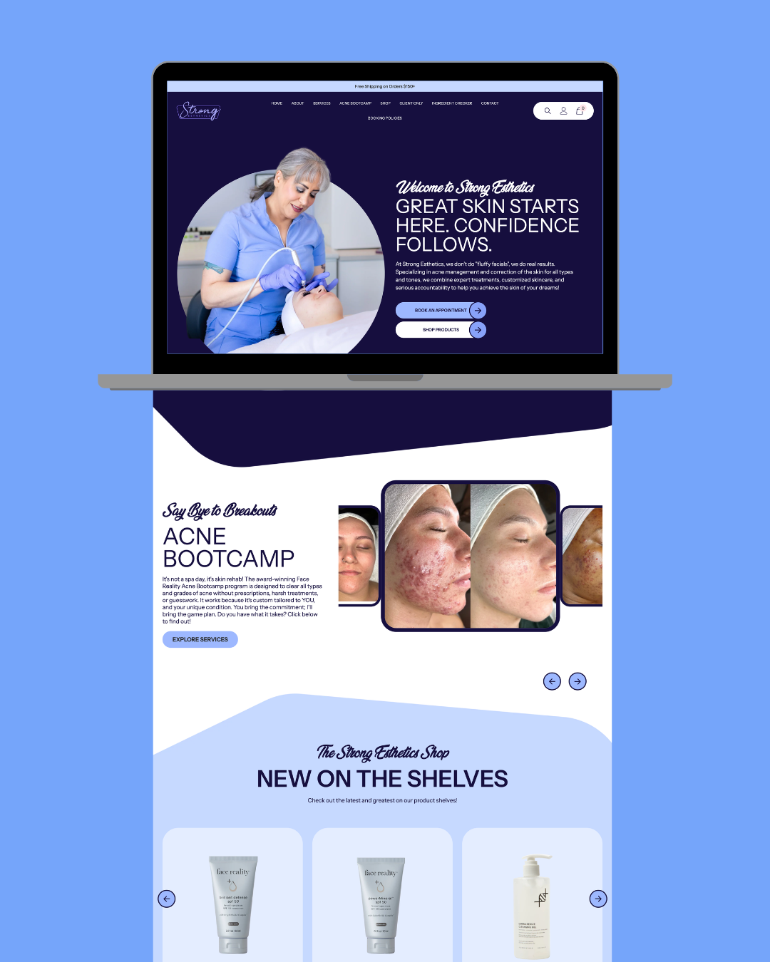 Laptop showing a skincare website. Features a woman performing a procedure, plus before & after acne treatment photos and product showcase.