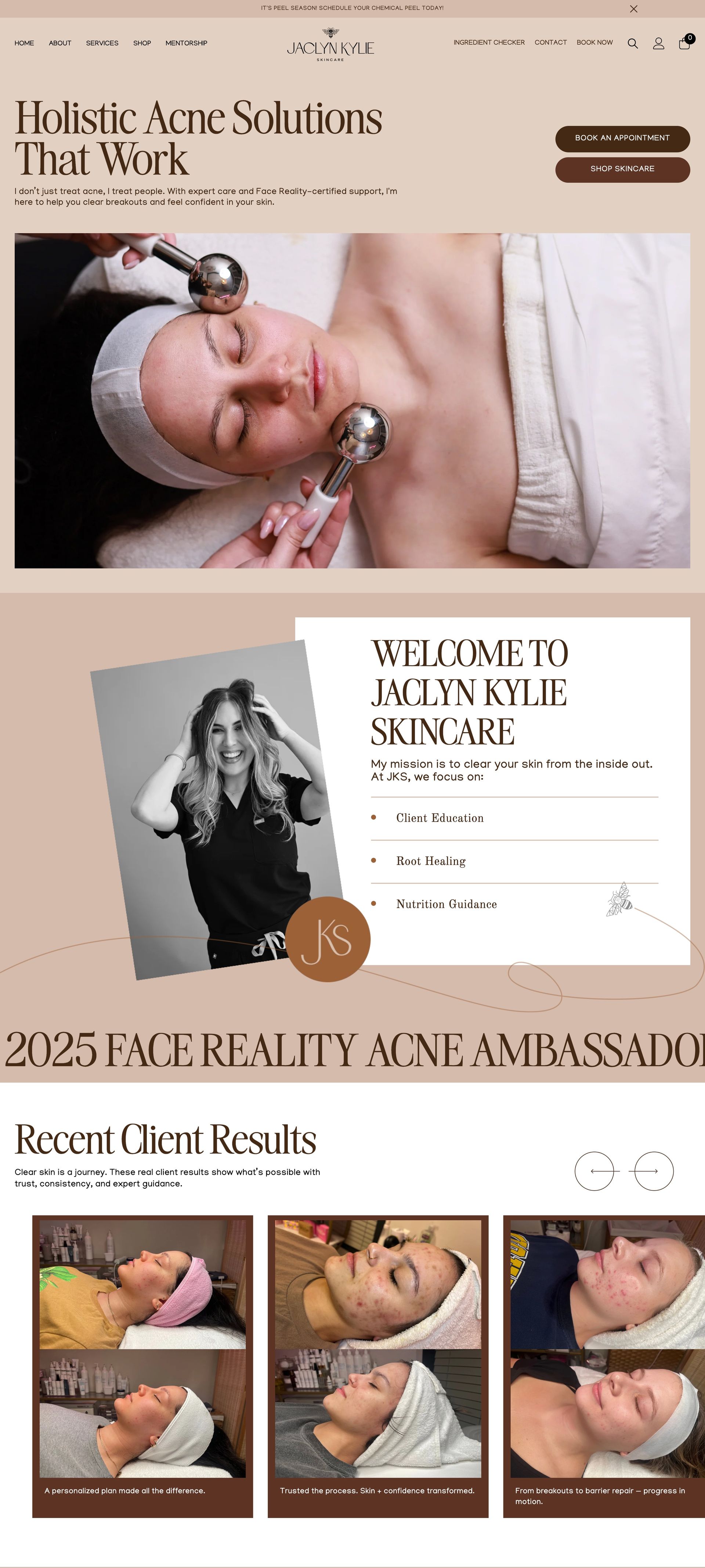 Website promoting Holistic Acne Solutions. A person gets facial treatment. Examples of the solutions are shown below.
