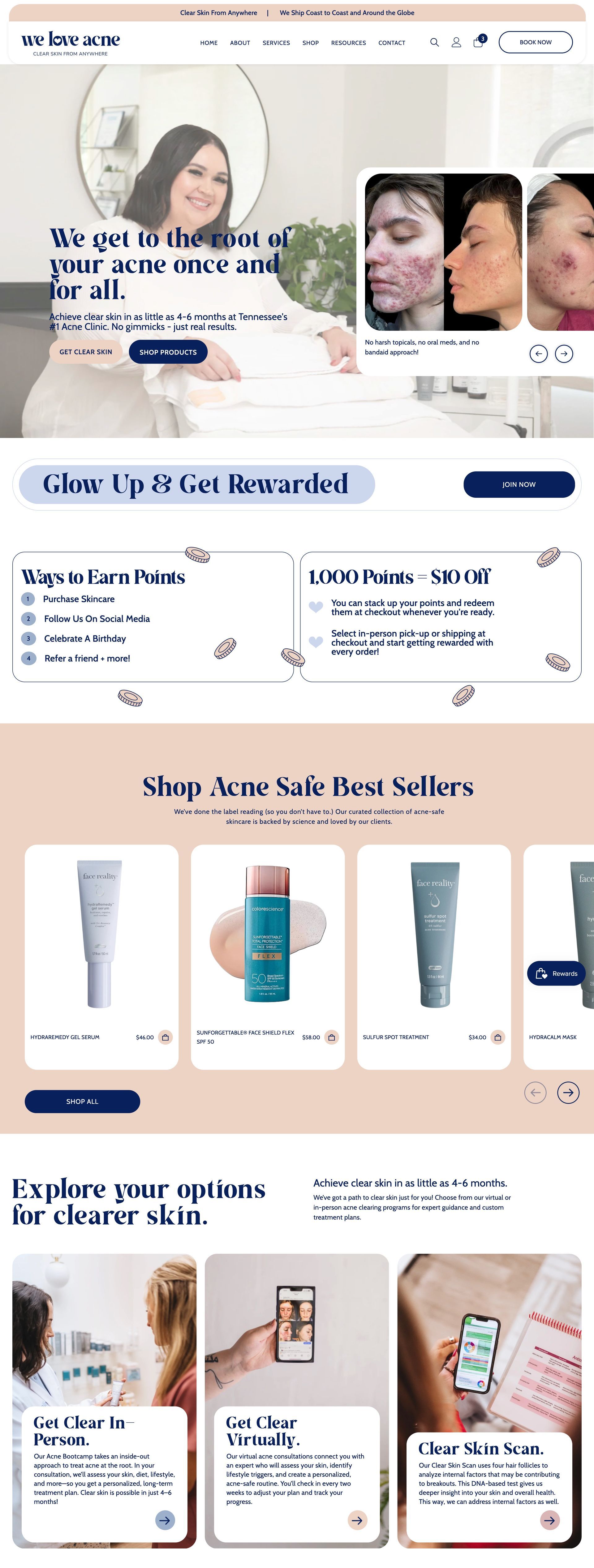 Website promoting skincare products, featuring before/after photos and product displays.