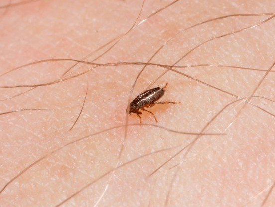 Un gros plan d'une puce sur la peau d'une personne