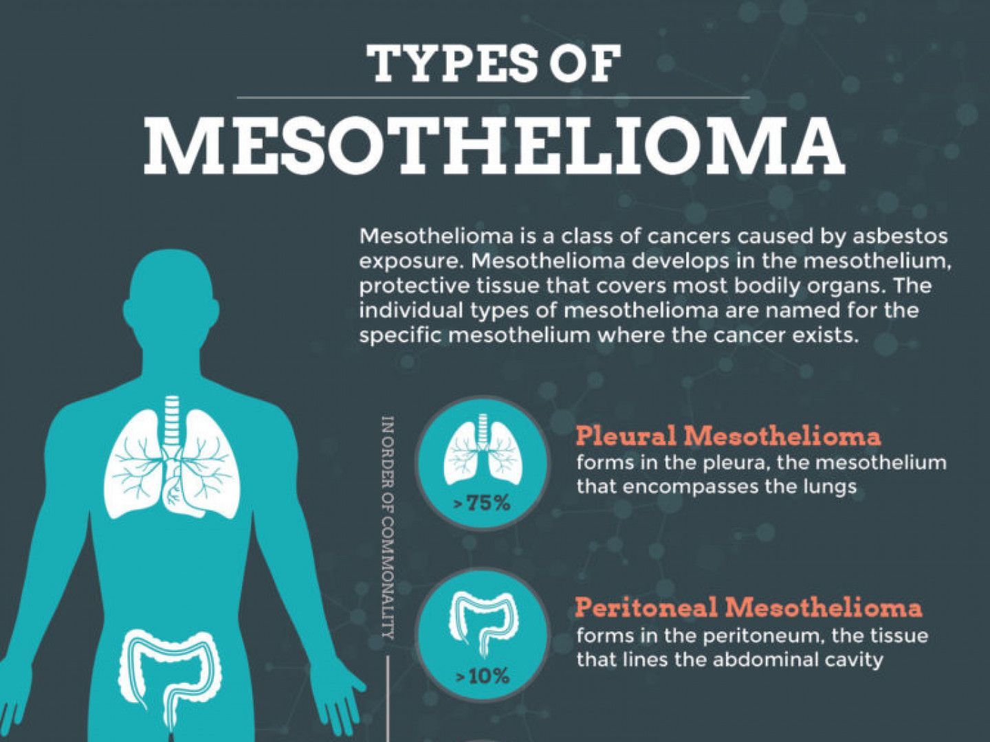 Types of Mesothelioma