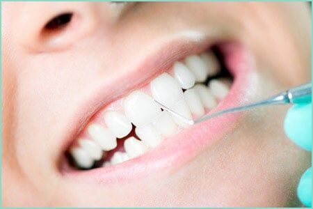 Dental Cleaning — Dental Care Service in Cambridge, MN