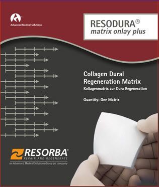 Resodura onlay plus