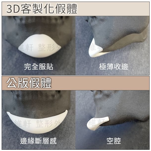 Bistool SOFTXiL二代矽膠的微細霧表面,與義乳的奈米絨毛相似,可以減少莢膜攣縮機會。