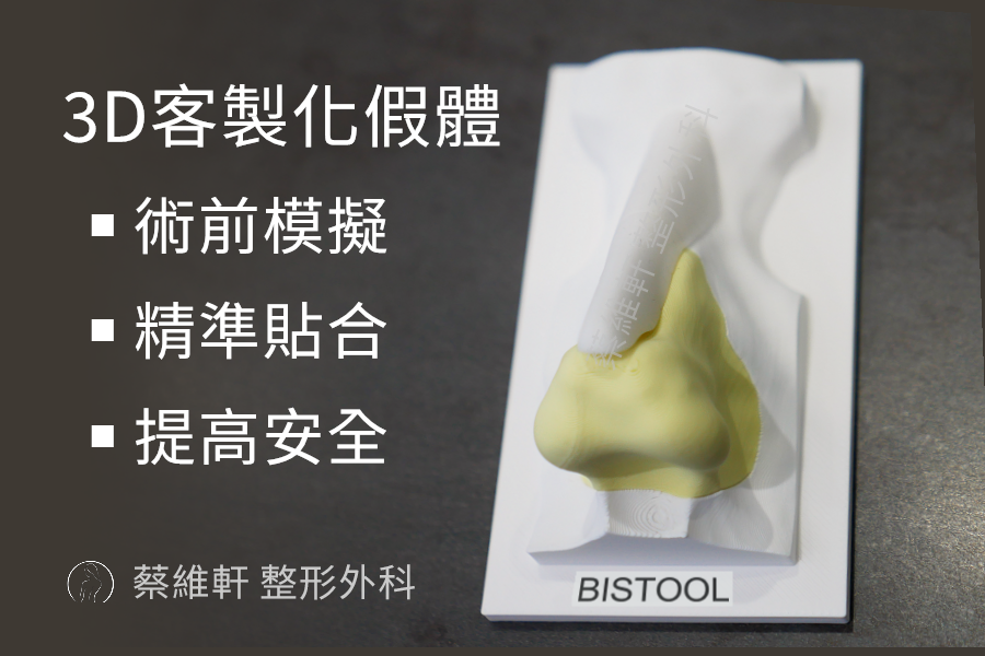 3D列印假體，能夠做到精準的術前模擬、極度貼合人體，Fitme完型美、Sofit、uniplan優尼美