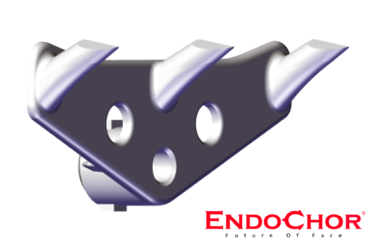 Endochor, endotine, 三爪釘