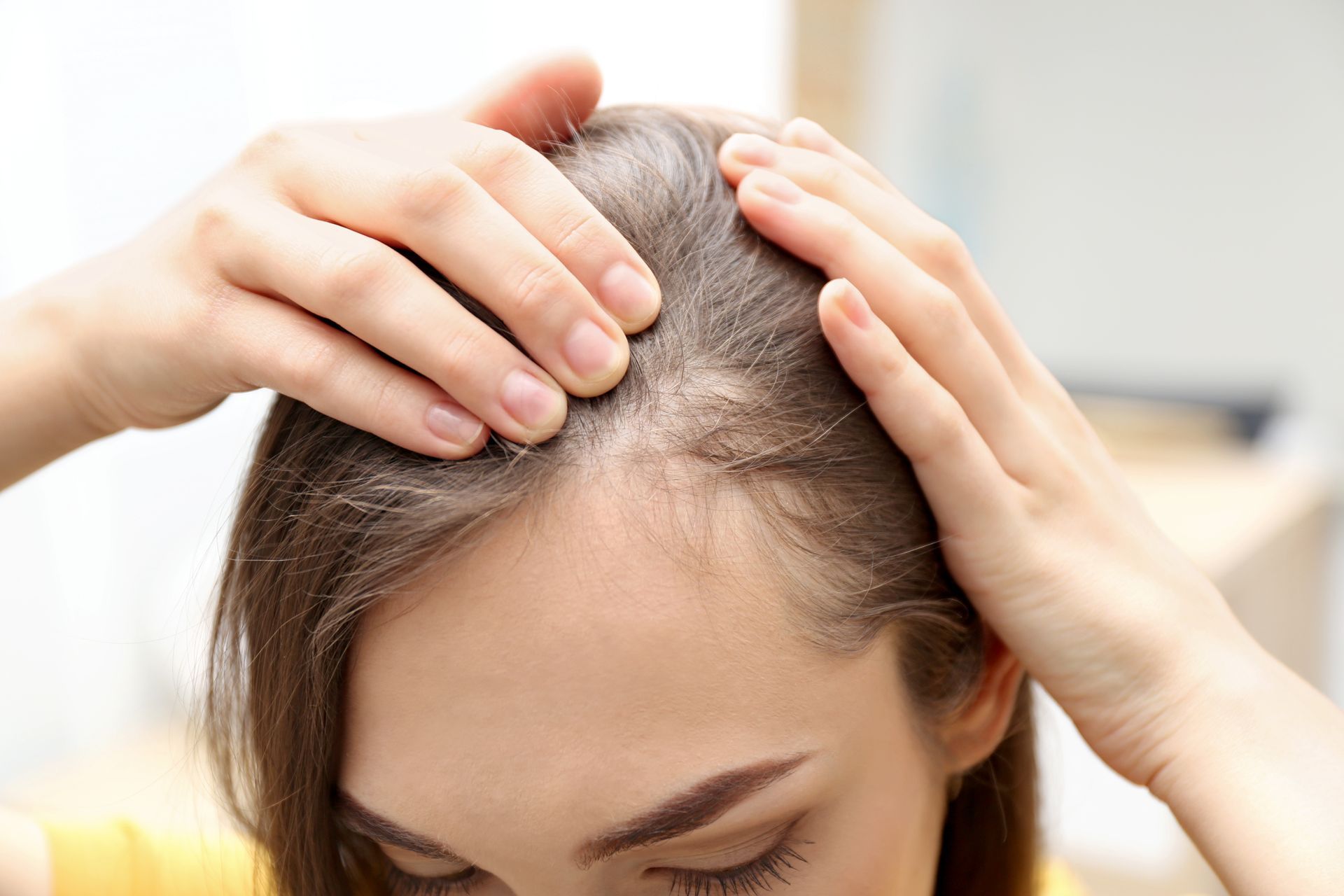 A woman's hands parting hair to show a thinning scalp area during an inspection for hair loss