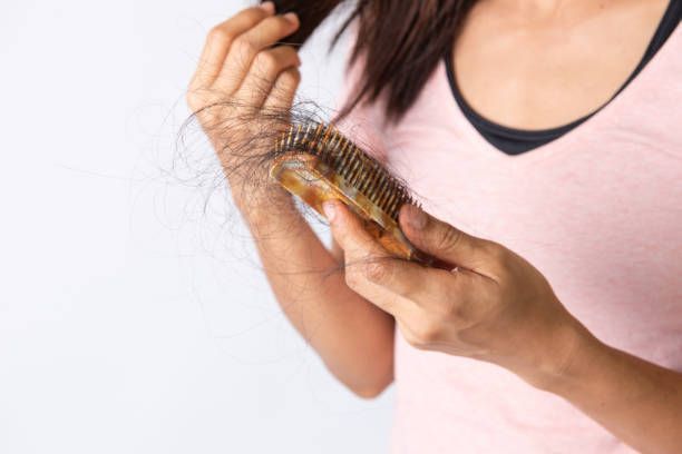 Close-up of a woman's hand holding hair falling in a comb, showcasing female hair loss.