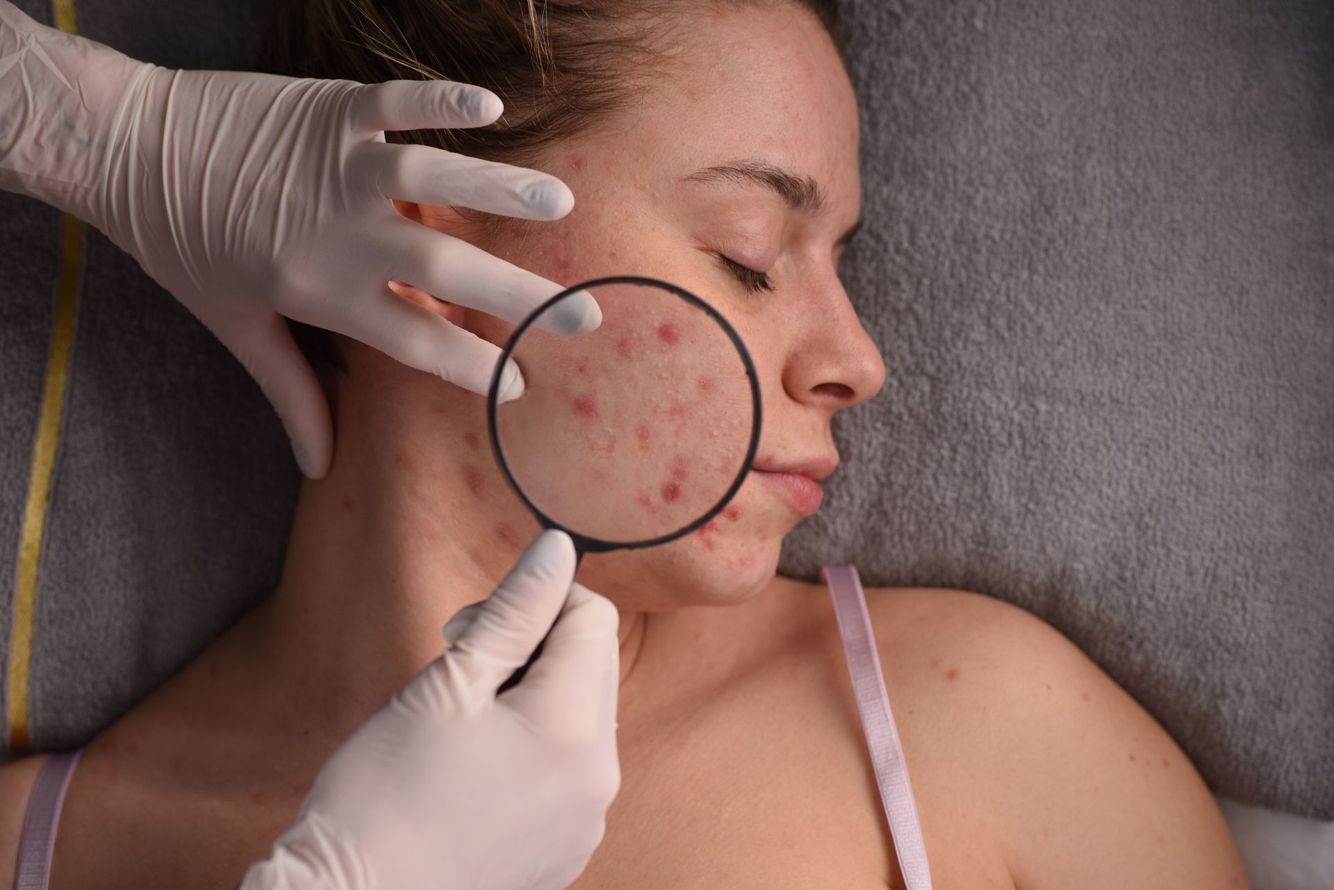 A Woman With Skin Irritation - New Bern, NC - ECDSS
