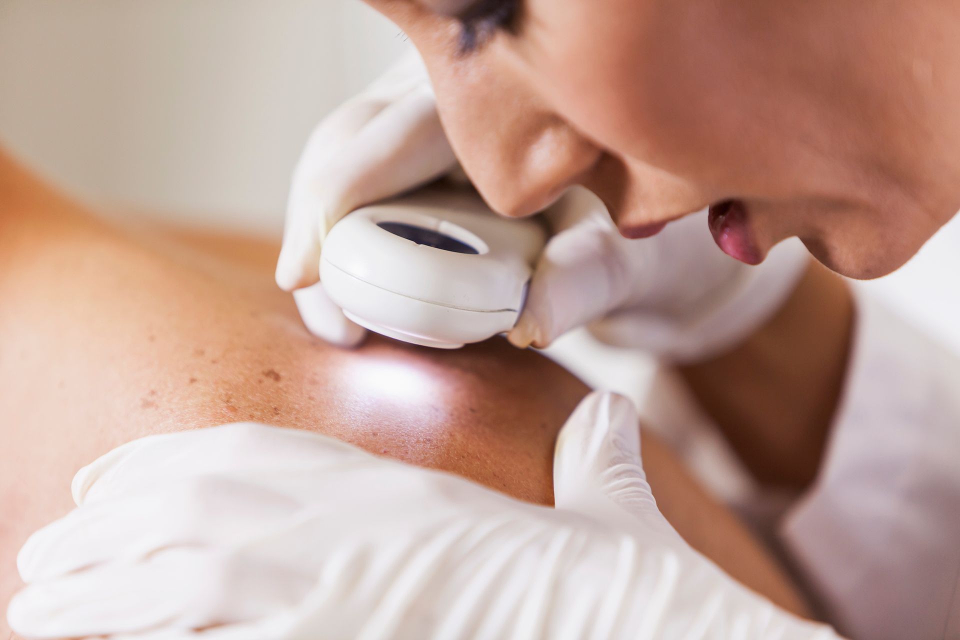 The Dermatologist Checks The Patient With Skin Cancer - New Bern, NC - ECDSS