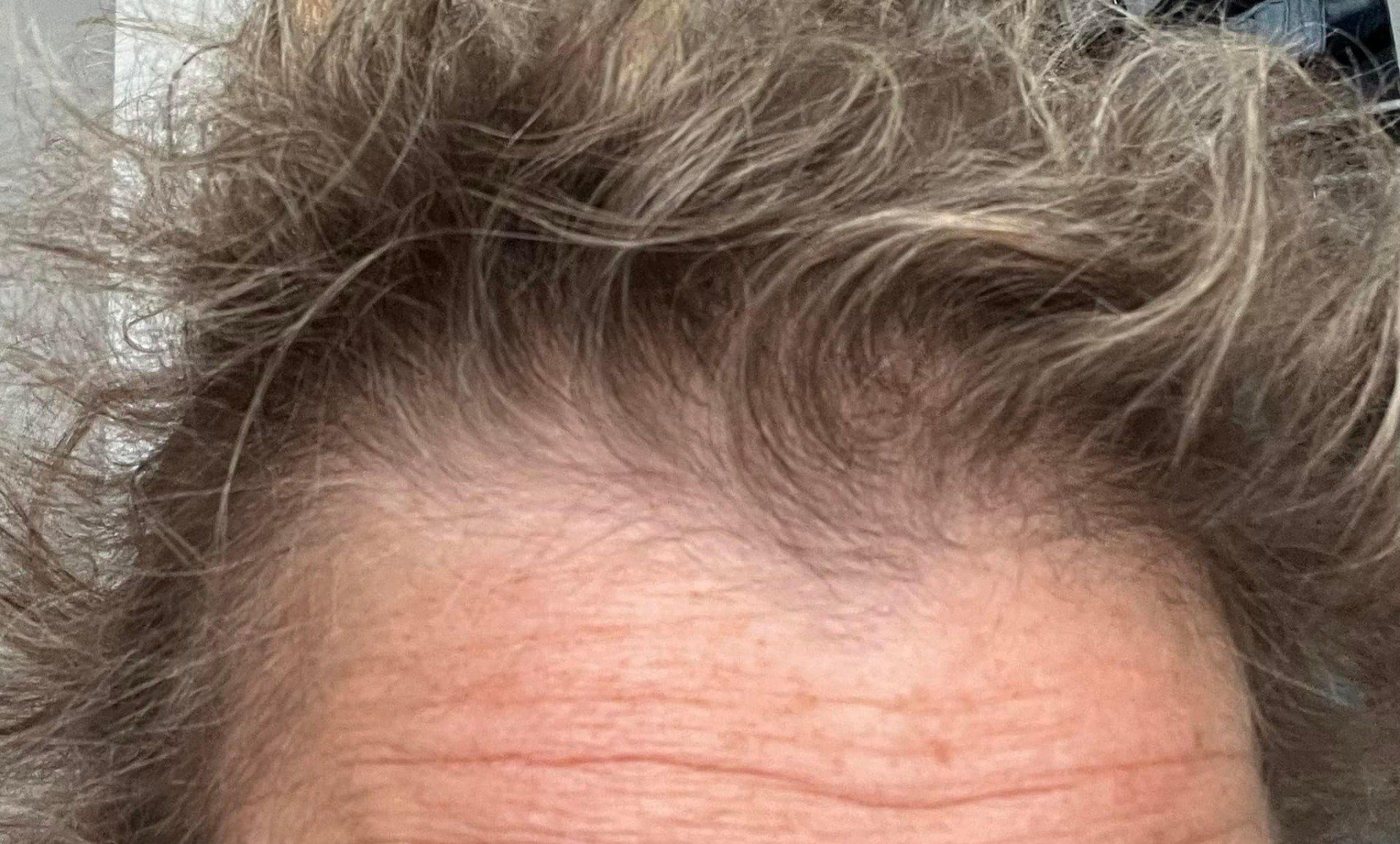 Very Close Capture Of Forehead - Denville, NJ - Jane’s Hair Salon