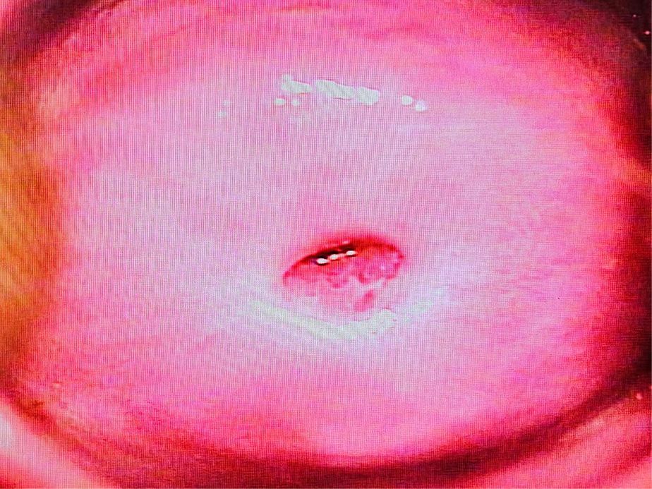 CLINICA DE DISPLASIAS LASER CIRUGIA S.C