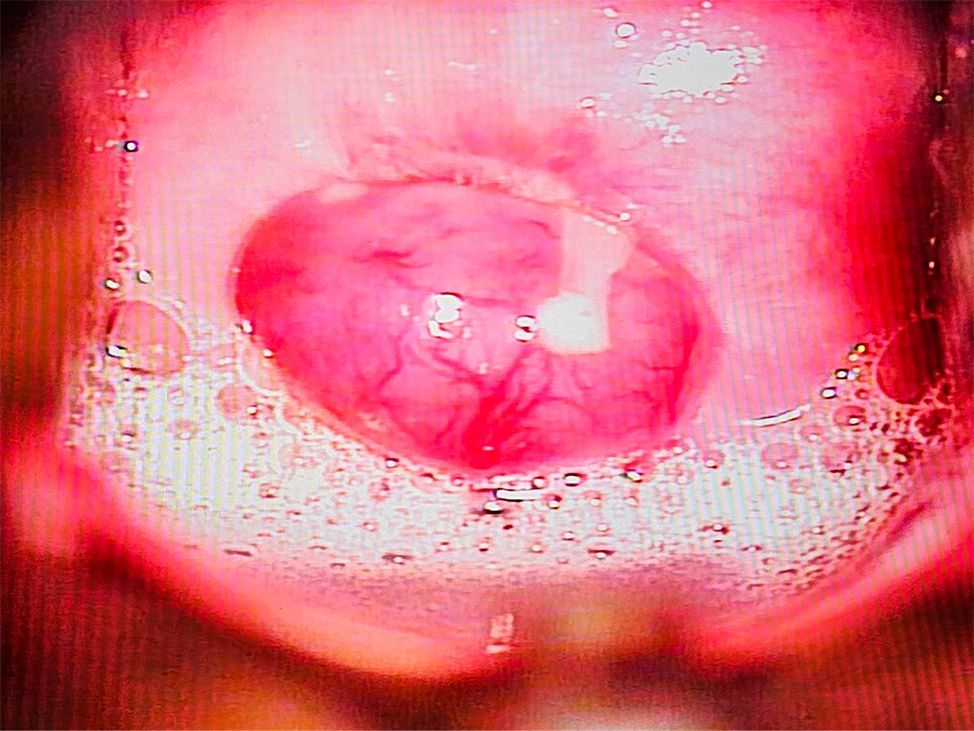 CLINICA DE DISPLASIAS LASER CIRUGIA S.C