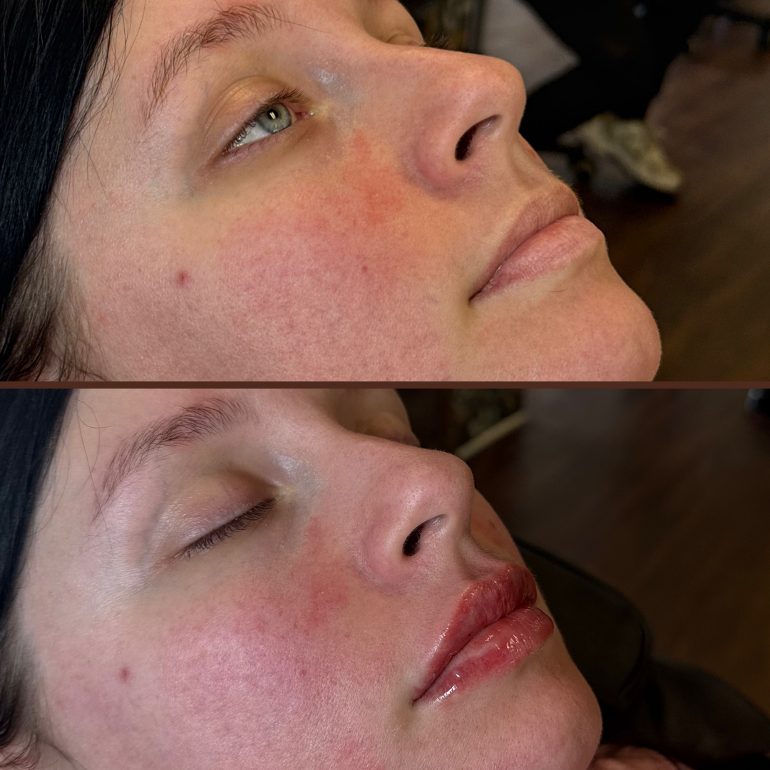A before and after picture of a woman's face
