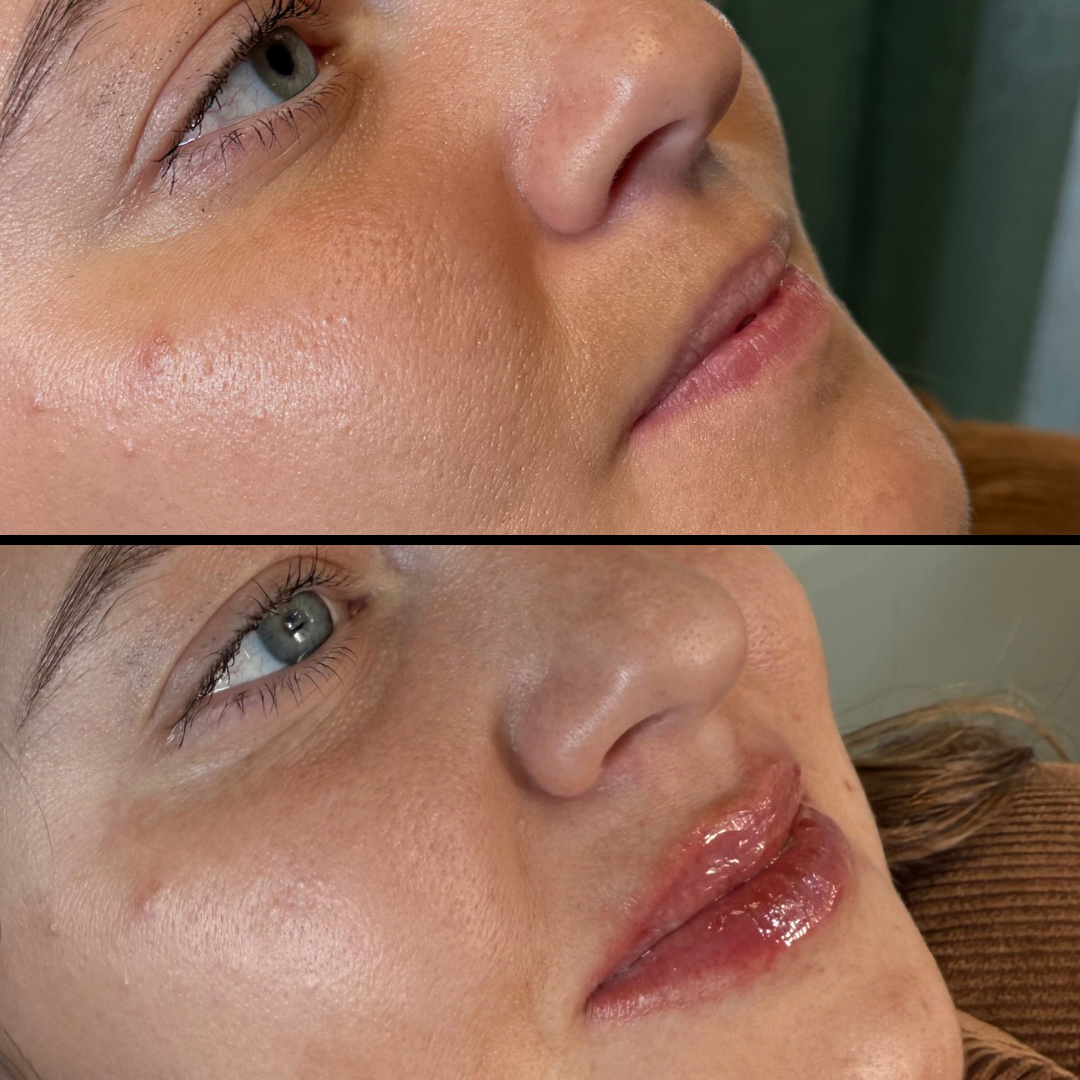 A woman is holding a syringe in her hand.