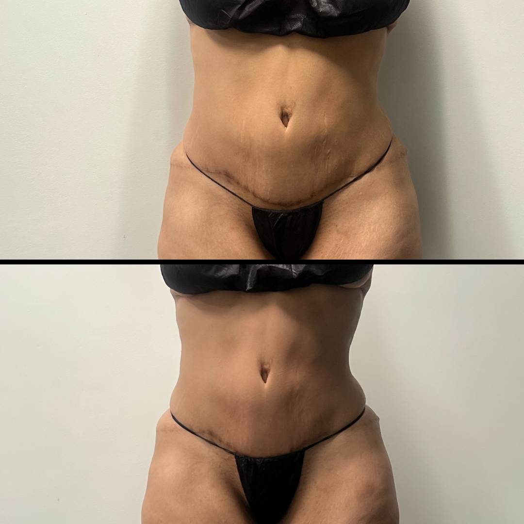 Two women are posing for a picture while one is sitting in a chair.