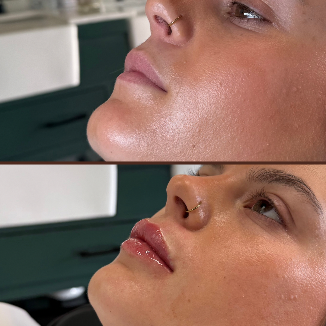 A before and after photo of a woman 's face.